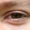 Macular Degeneration Cure May Lie in Enzyme Found by Scientists Macular degeneration cure
