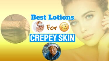 Image with text: "best lotions crepey skin on neck and face as well as on neck and arms".