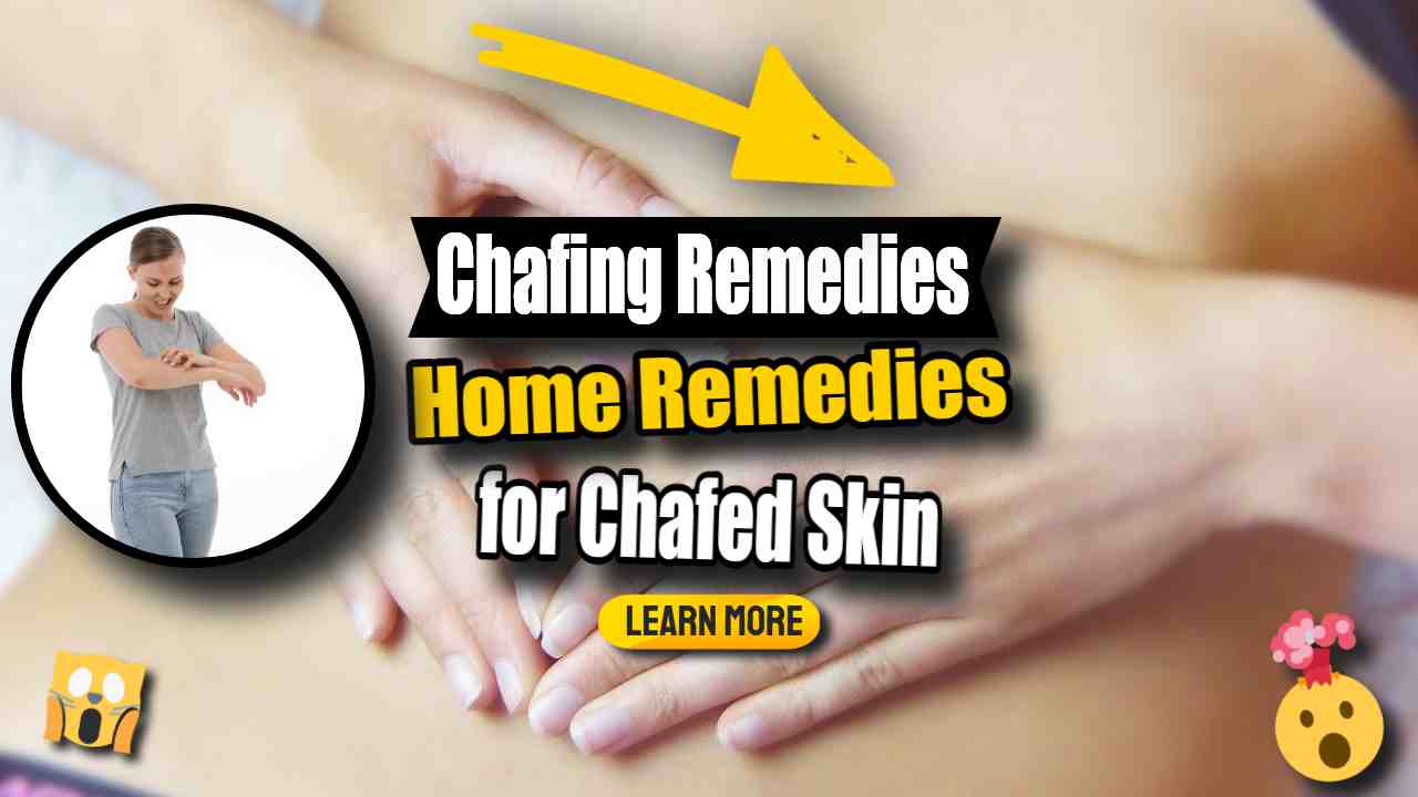 Image text: "Chafing Remedies - Chafed Skin Prevention and Cure".